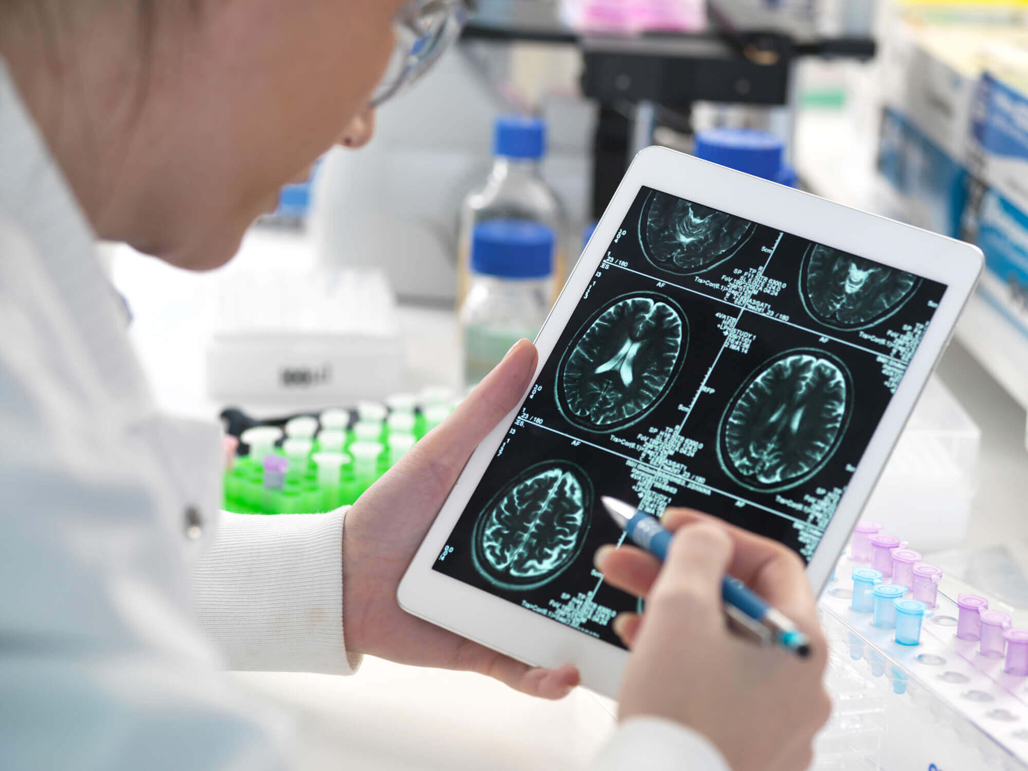 Identificazione precoce dei biomarcatori digitali per le patologie cognitive
